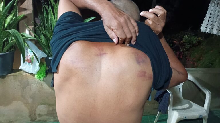 Moradores do distrito Tabajara (Machadinho do Oeste/RO) denunciam milícias armadas patrulhando a área, com agressões físicas e sinais de tortura, gerando temor de prisões e morte. Foto: registro da comunidade