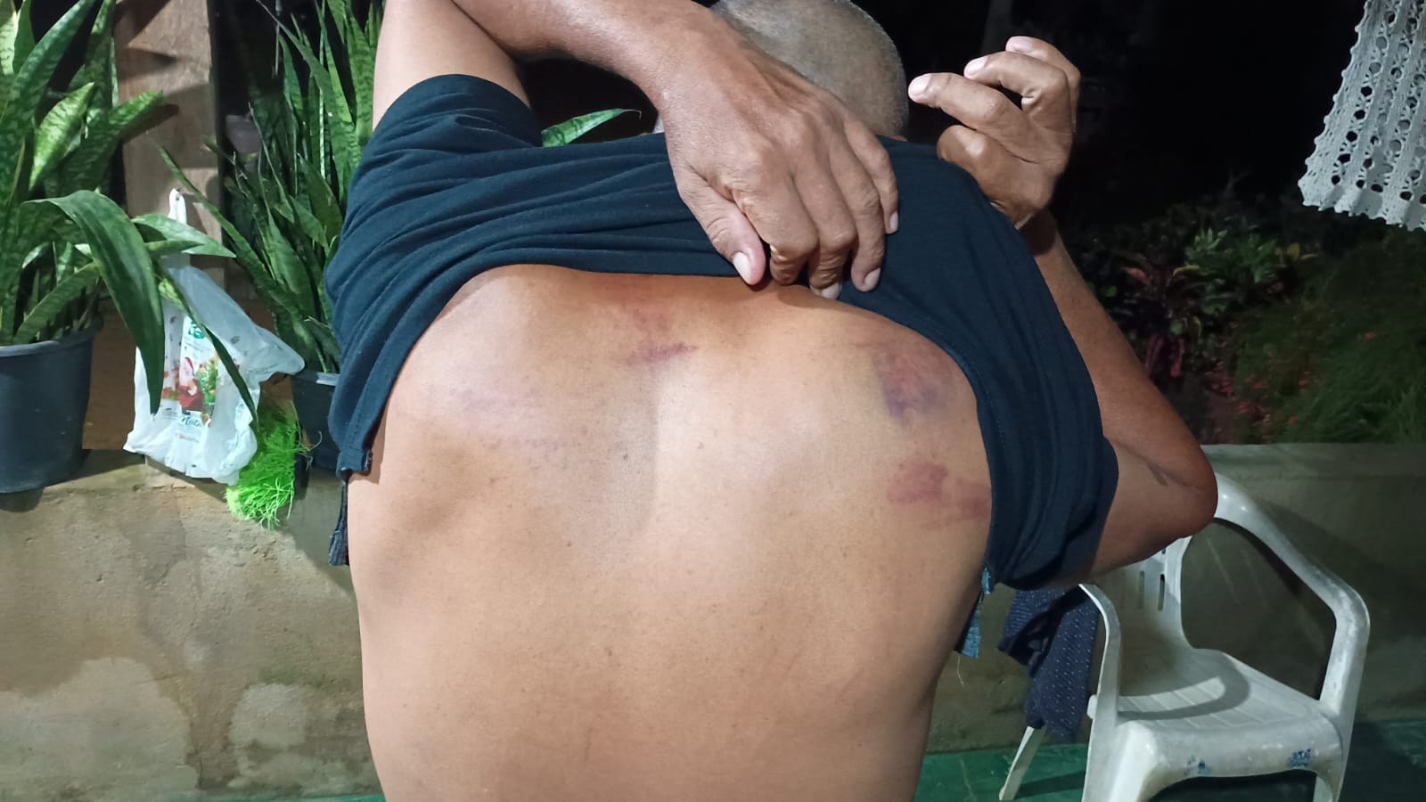 Moradores do distrito Tabajara (Machadinho do Oeste/RO) denunciam milícias armadas patrulhando a área, com agressões físicas e sinais de tortura, gerando temor de prisões e morte. Foto: registro da comunidade